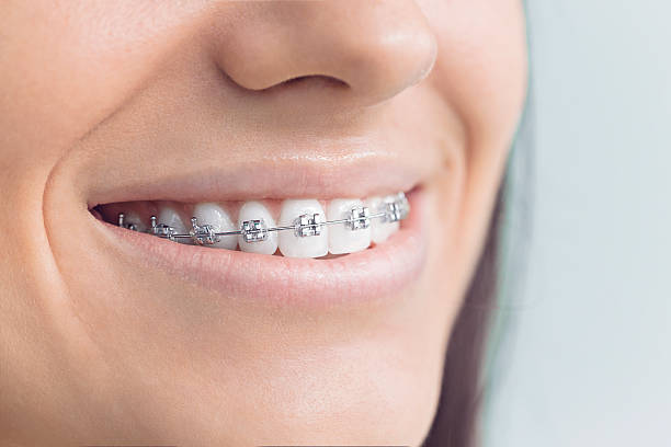 Reliable Citrus Park, FL  Holistic Dental Services Solutions